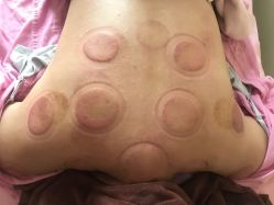 点击看大图 -伊童美家小儿推拿·中式养生(徐汇店)