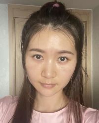 -天津健丽·去眼袋医疗美容机构