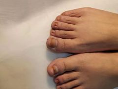 -世龙世家灰指甲鸡眼脚气甲沟炎跖疣护理(通州店)