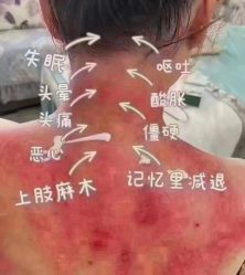 -香薇妮丝女子减肥院
