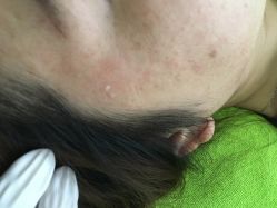 -荟草堂专业痘肌皮肤管理
