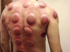 -澜珀养生馆·东北搓澡