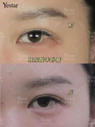 -Yestar艺星医疗美容医院