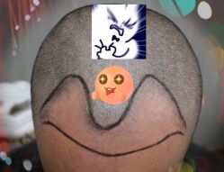 -大麦微针植发全国连锁