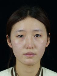 -青岛诺德医学美容医院