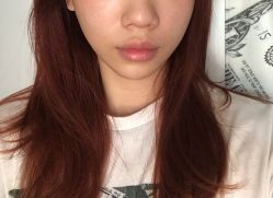 -广州美莱医疗美容医院