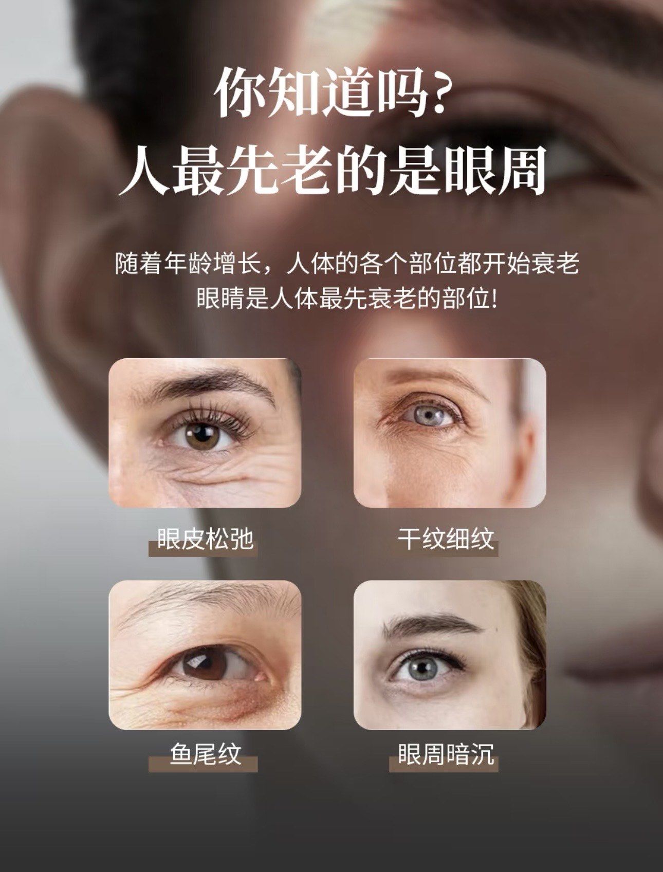 眼周是最先衰老的部位