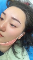 点击看大图 体验后-重庆联合丽格第五医疗美容医院