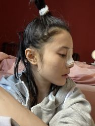 -北京米扬丽格医疗美容·联合丽格鼻整形中心