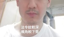 体验前-弘美医美·艾维岚童颜抗衰中心