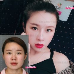 -北京米扬丽格医疗美容·联合丽格鼻整形中心