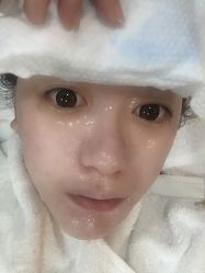 体验后-坤如玛丽·医疗美容中心