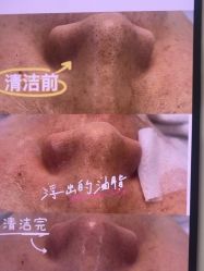 -SKIN79皮肤管理中心