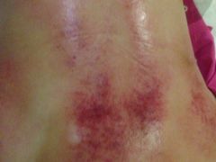 -莱蔻·圣灸堂·推拿艾灸(天山店)