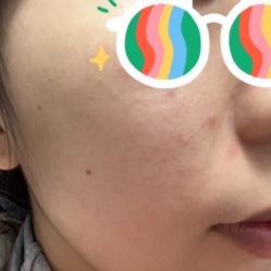 点击看大图 体验后-上海宏康医院·医疗美容科
