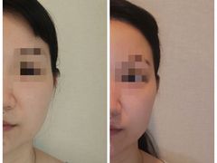 -FACE·日本小颜美容整骨(福田店)