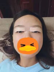 -成都西区医院整形美容