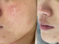 -Cream88颜皮肤管理中心