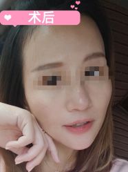 -素美医疗美容·西南眼鼻整形·修复基地