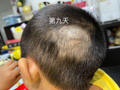 -广州市第一人民医院(院本部)