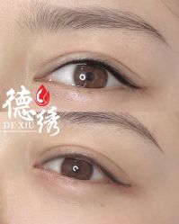 -德绣·机器野生眉发际线·美瞳线半永久