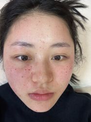 -长沙雅美医疗美容医院