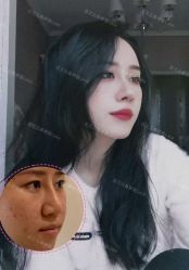 -北京米扬丽格医疗美容·联合丽格鼻整形中心