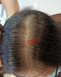 -诗碧曼养发