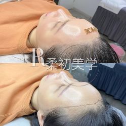 -RC半永久纹眉纹发际线