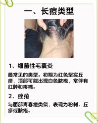 -Bollins波林丝•专研护发中心