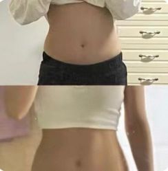 -Lily纤美·科技减脂中心
