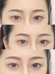 -杨益美学·野生眉半永久纹眉发际线