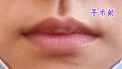 -圣嘉新医疗美容医院