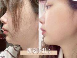 点击看大图 -长沙雅美医疗美容医院