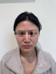 体验前-杭州美莱医疗美容医院