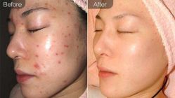 -SKINIST丽铂医疗美容