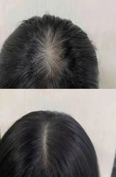 -希梵尔头皮抗衰·科技养发