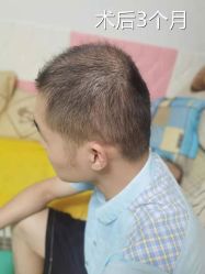 -雍禾植发全国连锁