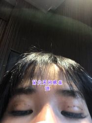 体验后-上海宏康医院·医疗美容科