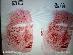 -skin79皮肤管理中心