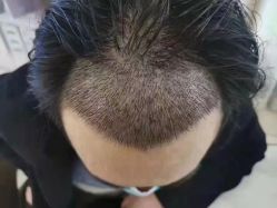 -西安壹加壹医疗美容·西北抗衰旗舰店