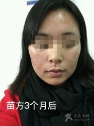 -苗方清颜专业祛痘