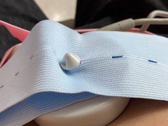 -苏州高新区人民医院