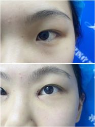 -郡艺医疗美容·微整·眼鼻吸脂