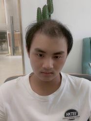 -发饰美男士增发补发假发定制店