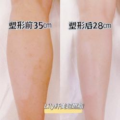 -Lily纤美·科技减脂中心