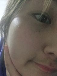 体验后-联合丽格·张菡丽格医疗美容