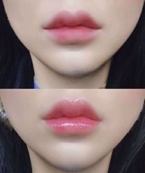 -SKINIST丽铂医疗美容