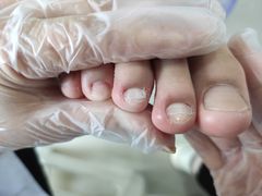 -世龙世家甲沟炎·灰指甲·嵌甲矫正·修脚(武侯区双楠店)