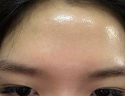 -比华利美容医院